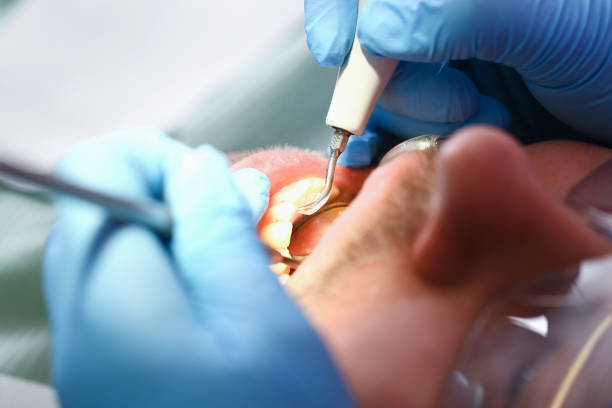 Best Urgent Dental Care for Toothache in Lowes Island, VA