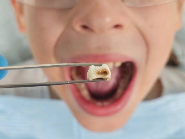 Best Emergency Dentist for Special Needs Patients in Lowes Island, VA