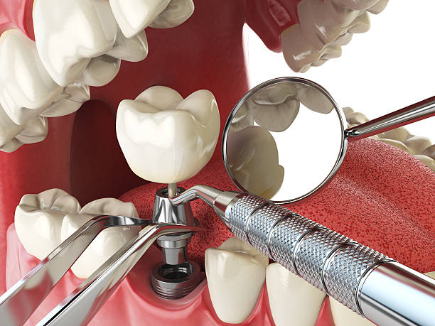 Best Emergency Dentist for Special Needs Patients in Lowes Island, VA