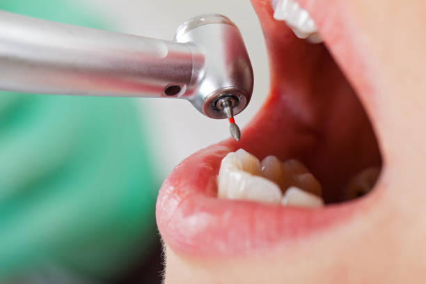 Best Emergency Dental Services for Seniors in Lowes Island, VA